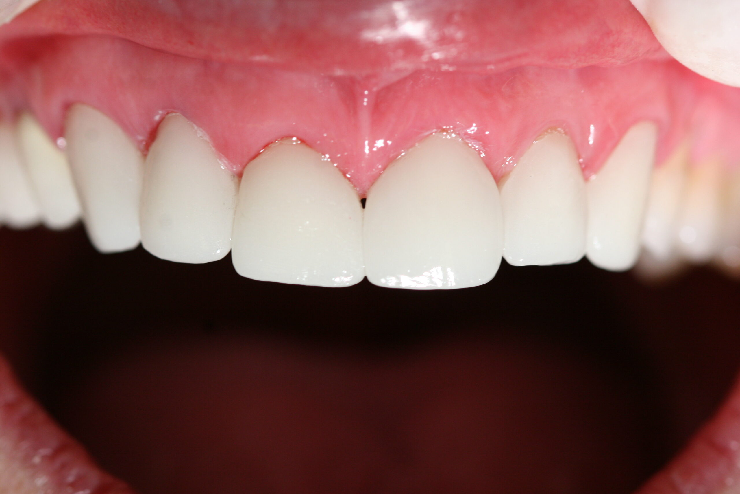 After – Patient Results