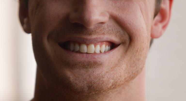 Cropped view unrecognizable Caucasian man smile toothy male teeth smiling happy joyful carefree cheerful guy home medical clinic orthodontic oral dentistry hygiene dental health whitening procedure. High quality 4k footage