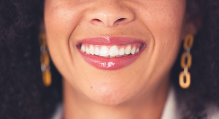 oral-hygiene-closeup-of-a-woman-smiling-and-showi-2023-11-27-05-26-10-utc