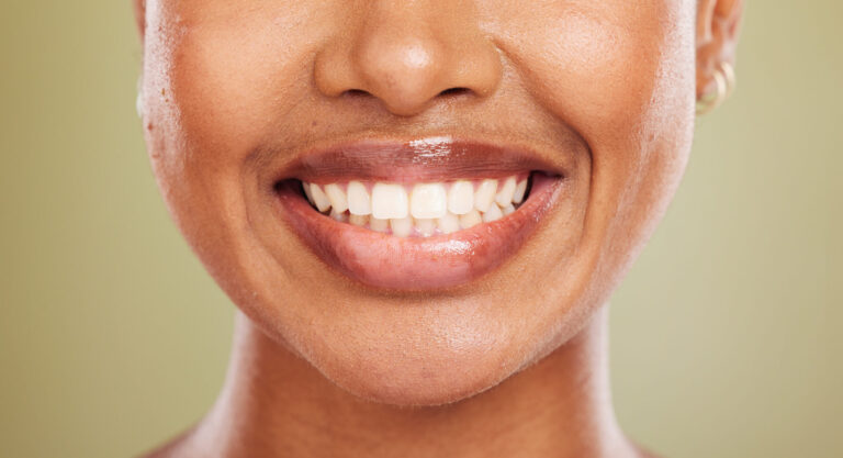 Smile, teeth and mouth of black woman closeup on studio background for dental care or cosmetics. He.